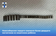Новосибирские хирурги провели операцию по извлечению более двадцати магнитов из кишечника ребёнка.